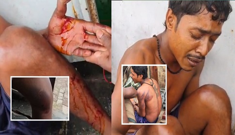 বঙ্গোপসাগরে দুই জেলে গ্রুপর মধ্যে সংঘর্ষ, আহত ৩