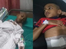 লিভারে টিউমার-শরীরে ক্যান্সার, বাঁচতে চায় শিশু মেহেরাজ