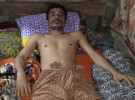 টাকার অভাবে হচ্ছেনা চিকিৎসা, ৬ মাস ধরে বিছানায় অসিম 