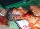 একই পরিবারের ১০ জনকে পিটিয়ে ও কুপিয়ে জখম