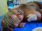 শ্যামনগরে খালের দখল নিয়ে ত্রি-মুখী সংঘর্ষ, আহত ৯