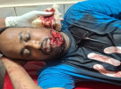 প্রাইভেটকারে গুলি করে স্বেচ্ছাসেবক দল নেতাকে কুপিয়ে জখম
