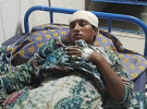 ফরিদপুরে বড় ভাইয়ের বউকে কুপিয়ে জখম করেছে ছোটভাইয়ের পরিবার