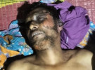 সাতক্ষীরায় ট্রান্সফর্মার চুরি করতে যেয়ে বিদ্যুৎস্পৃষ্ট হয়ে  চোরের মৃত্যু