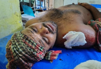 শ্যামনগরে খালের দখল নিয়ে ত্রি-মুখী সংঘর্ষ, আহত ৯