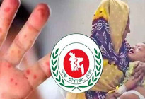 হাম ও উপসর্গ নিয়ে আরও ৫ শিশুর মৃত্যু