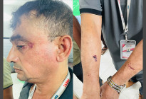 সাংবাদিক ও রিয়েল এস্টেট কোম্পানীর পরিচালক ছিদ্দিকুর রহমানের উপর হামলা ও অপহরনের চেষ্টা