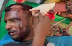 নড়াইলে আধিপত্য বিস্তারকে কেন্দ্র করে দু'পক্ষের সংঘর্ষে নারীসহ আহত ১৫ 