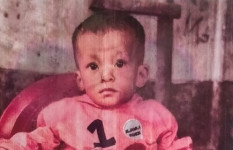 টাকার অভাবে নিভতে চলেছে ১৮ মাসের মেশিংওয়াং’র জীবন প্রদীপ