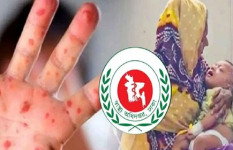 হামের উপসর্গে ১৬ জনের মৃত্যু