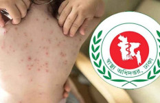 হামের উপসর্গ নিয়ে আরও ৩ শিশুর মৃত্যু