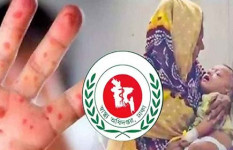 হাম ও উপসর্গ নিয়ে আরও ৫ শিশুর মৃত্যু