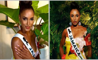 মিস ইউনিভার্সের মঞ্চে আহত হয়ে আইসিউতে জ্যামাইকান সুন্দরী