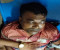 সালথায় যুবককে কুপিয়ে পায়ের পাঁচ আঙুল বিচ্ছিন্ন
