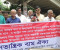 হামে আক্রান্ত হয়ে শিশু মৃত্যুর দায়ে ড. ইউনুসের বিচার দাবি
